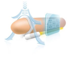 Andropenis Mini extenseur pénien 8 cm pour le bien-être intime – photo 6